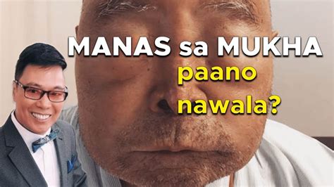 tinamuran sa mukha|Tinamuran Sa Mukha Ang Chinitang Si Divine.